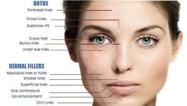 Dermal Fillers Oklahoma City, OK
